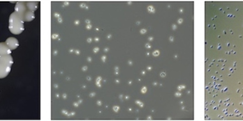 Brettanomyces: Science & Context